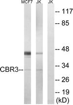 CBR3 Antibody in Western Blot (WB)