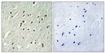 CNTROB Antibody in Immunohistochemistry (Paraffin) (IHC (P))