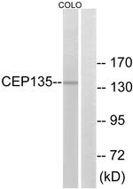 CEP135 Antibody in Western Blot (WB)