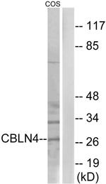 Cerebellin 4 Antibody in Western Blot (WB)