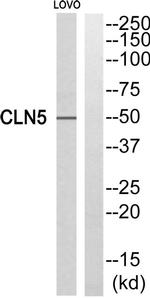 CLN5 Antibody in Western Blot (WB)