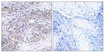 CLN6 Antibody in Immunohistochemistry (Paraffin) (IHC (P))