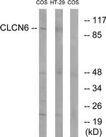 CLCN6 Antibody in Western Blot (WB)