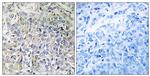 CSGALNACT2 Antibody in Immunohistochemistry (Paraffin) (IHC (P))