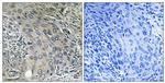 COPZ1 Antibody in Immunohistochemistry (Paraffin) (IHC (P))