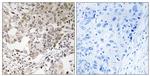 NCAPG2 Antibody in Immunohistochemistry (Paraffin) (IHC (P))