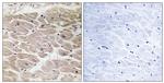 CCP2 Antibody in Immunohistochemistry (Paraffin) (IHC (P))