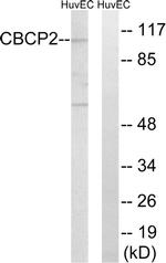 CCP2 Antibody in Western Blot (WB)