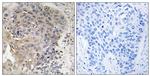 CCP3 Antibody in Immunohistochemistry (Paraffin) (IHC (P))