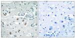 PLA2G4D Antibody in Immunohistochemistry (Paraffin) (IHC (P))
