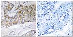 DHRS11 Antibody in Immunohistochemistry (Paraffin) (IHC (P))