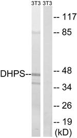DHPS Antibody in Western Blot (WB)