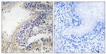 DHODH Antibody in Immunohistochemistry (Paraffin) (IHC (P))