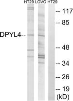 CRMP3 Antibody in Western Blot (WB)