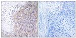 POLG2 Antibody in Immunohistochemistry (Paraffin) (IHC (P))