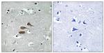 MARCH3 Antibody in Immunohistochemistry (Paraffin) (IHC (P))