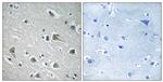 MYLIP Antibody in Immunohistochemistry (Paraffin) (IHC (P))