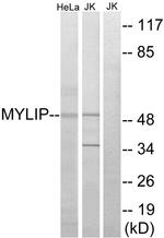MYLIP Antibody in Western Blot (WB)