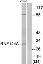 RNF144A Antibody in Western Blot (WB)