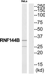 RNF144B Antibody in Western Blot (WB)