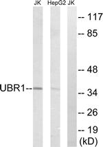 UBR1 Antibody in Western Blot (WB)