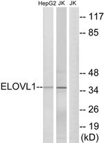 ELOVL1 Antibody in Western Blot (WB)
