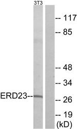 KDELR3 Antibody in Western Blot (WB)