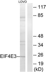 eIF4E3 Antibody in Western Blot (WB)