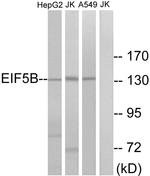 eIF5B Antibody in Western Blot (WB)