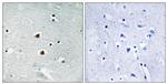 FOXJ3 Antibody in Immunohistochemistry (Paraffin) (IHC (P))