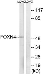 FOXN4 Antibody in Western Blot (WB)