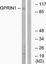 GPRIN1 Antibody in Western Blot (WB)