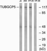 GCP5 Antibody in Western Blot (WB)