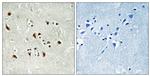 GPC6 Antibody in Immunohistochemistry (Paraffin) (IHC (P))