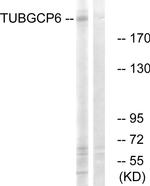 GPC6 Antibody in Western Blot (WB)