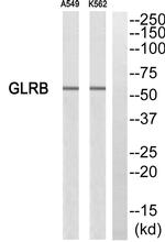 GLRB Antibody in Western Blot (WB)