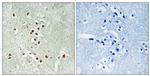 GADD45GIP1 Antibody in Immunohistochemistry (Paraffin) (IHC (P))