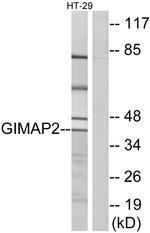 GIMAP2 Antibody in Western Blot (WB)