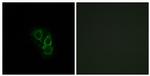 RRAD Antibody in Immunocytochemistry (ICC/IF)