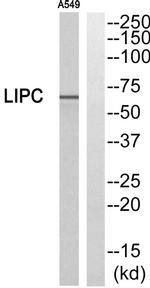LIPC Antibody in Western Blot (WB)