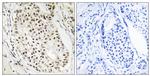 hnRNP UL2 Antibody in Immunohistochemistry (Paraffin) (IHC (P))