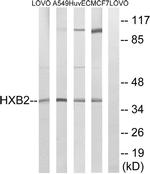 HOXB2 Antibody in Western Blot (WB)