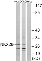Nkx2.6 Antibody in Western Blot (WB)