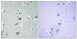 Kir2.1 (KCNJ2) Antibody in Immunohistochemistry (Paraffin) (IHC (P))