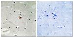 KIF13B Antibody in Immunohistochemistry (Paraffin) (IHC (P))