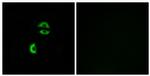 LDLRAD3 Antibody in Immunocytochemistry (ICC/IF)