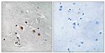 MED13L Antibody in Immunohistochemistry (Paraffin) (IHC (P))