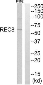 REC8 Antibody in Western Blot (WB)
