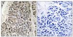 MRPS21 Antibody in Immunohistochemistry (Paraffin) (IHC (P))