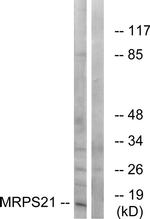 MRPS21 Antibody in Western Blot (WB)